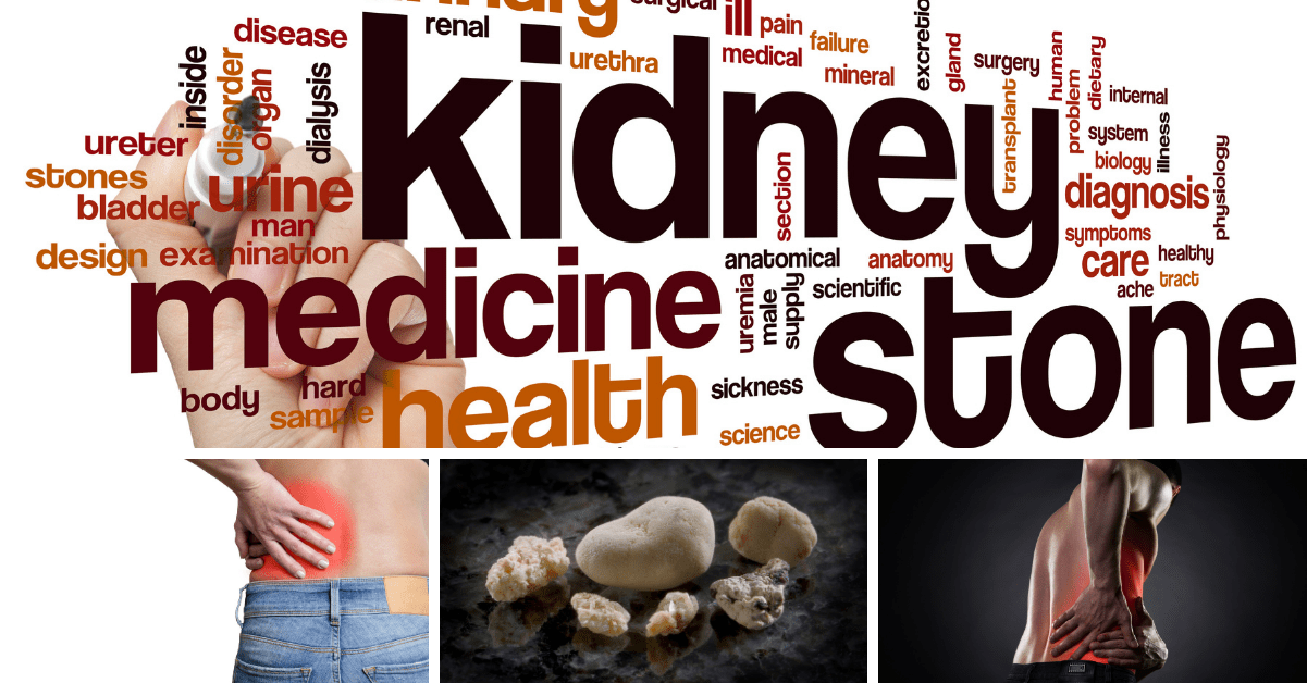 Kidney Stone, kidney pain