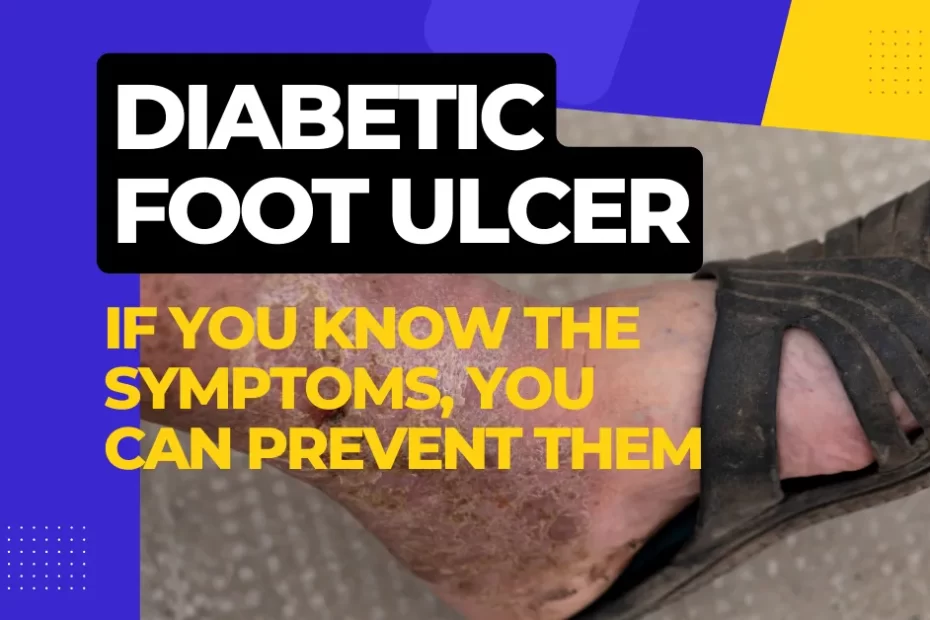 diabetes foot ulcers, foot care